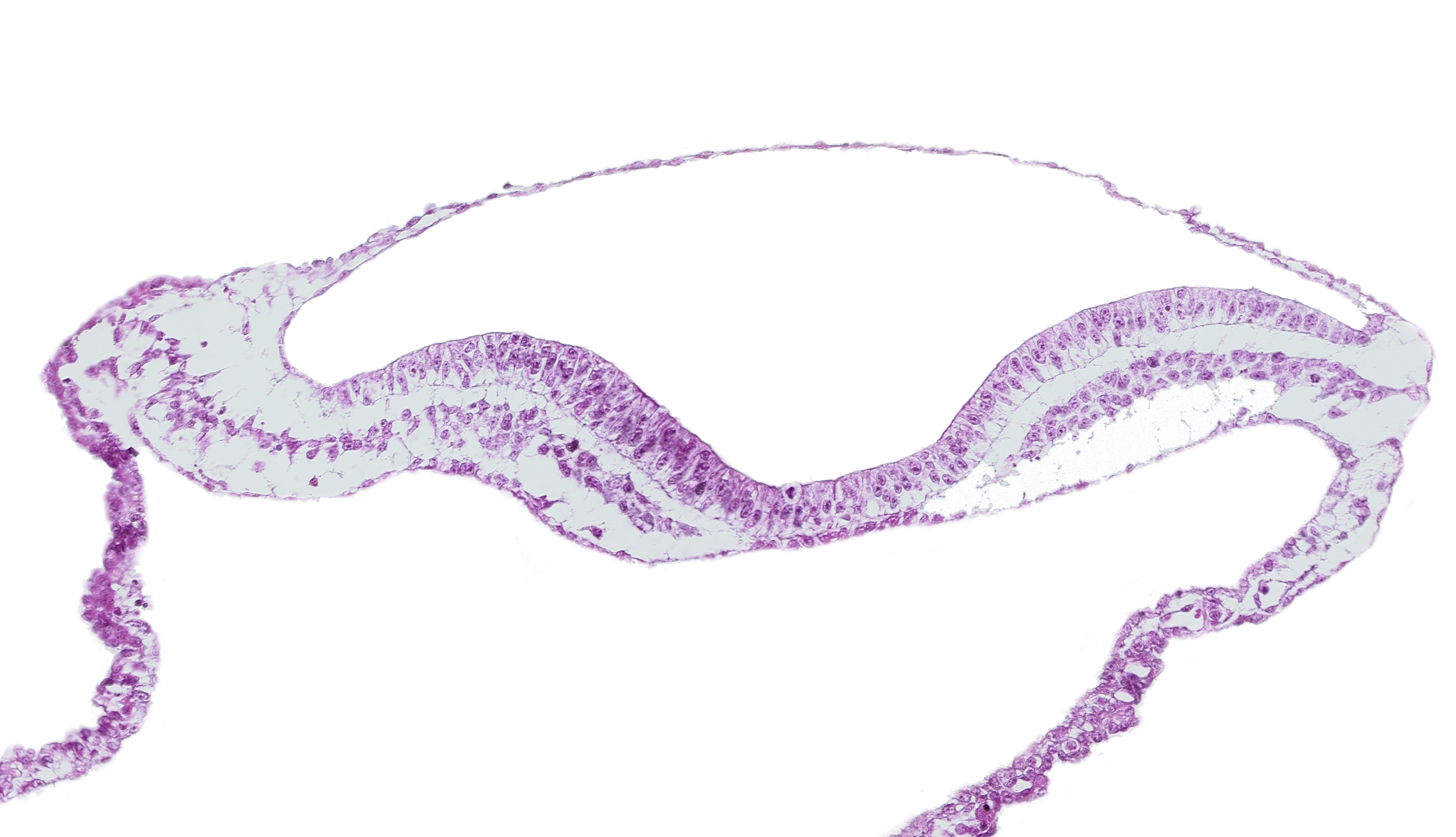amnion, blood vessel(s), extra-embryonic endoderm, extra-embryonic mesoderm, head mesenchyme, neural fold, neural groove, notochordal plate, ventral groove (artifact?)