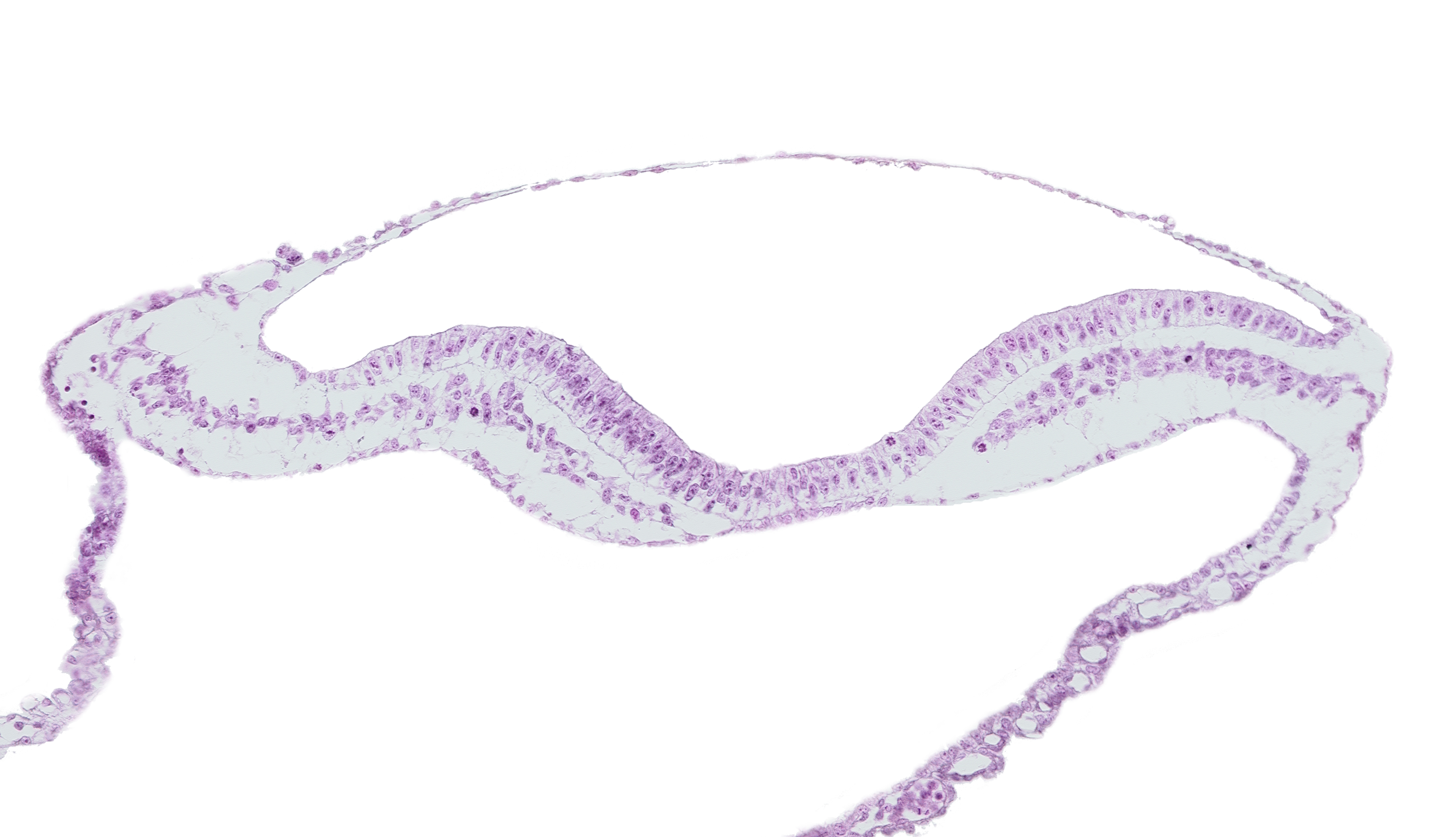 amniotic cavity, endoderm, umbilical vesicle cavity