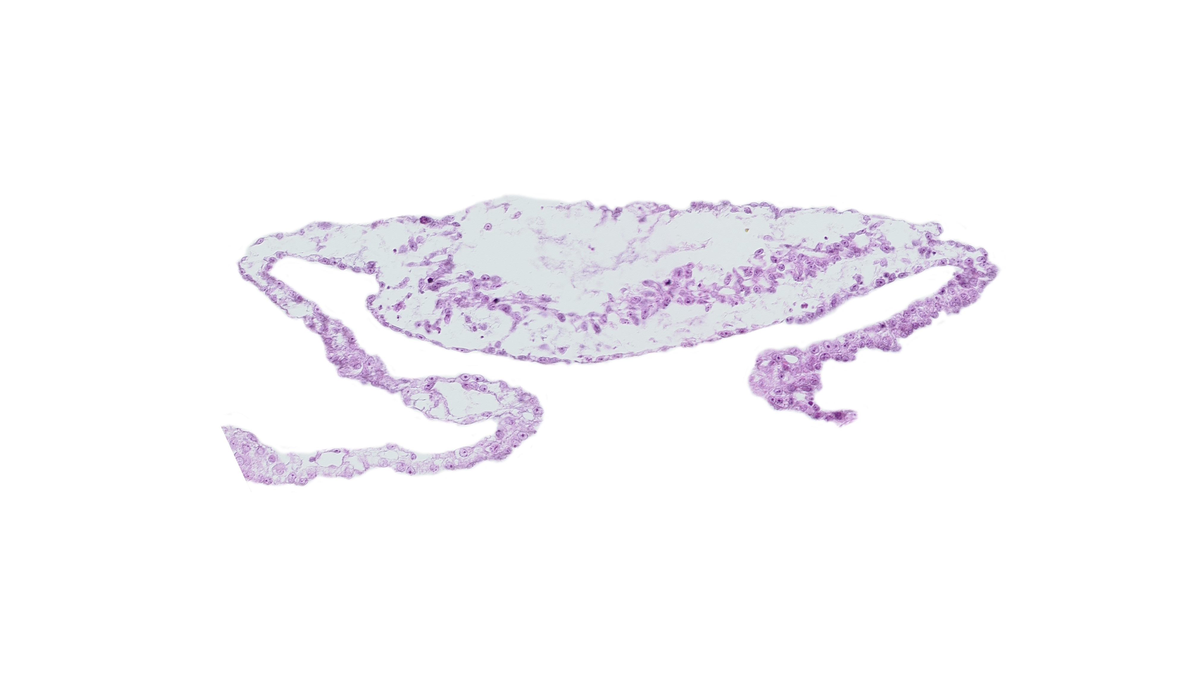 cardiac mesoderm