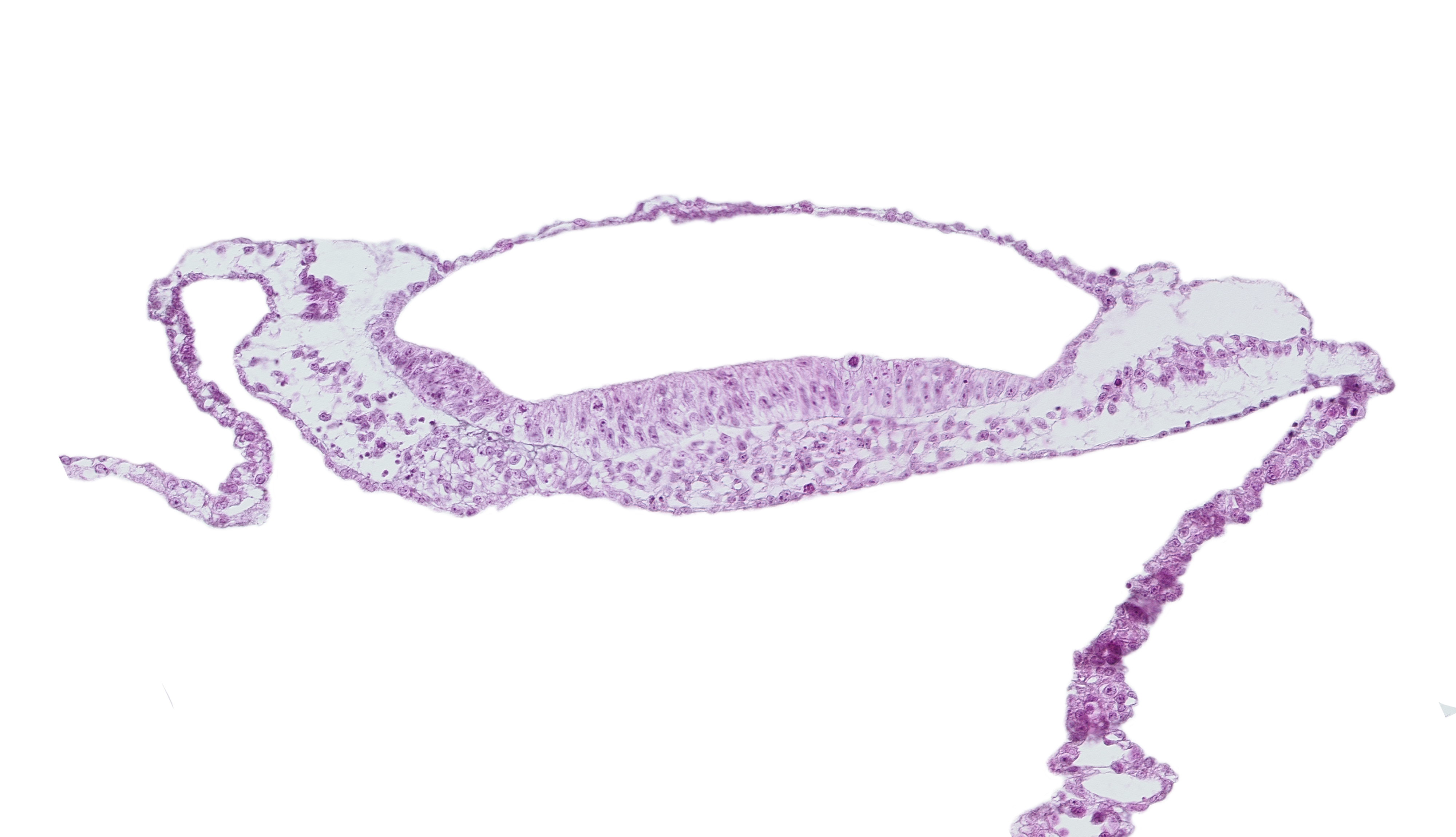 neural groove, neural plate, prechordal plate