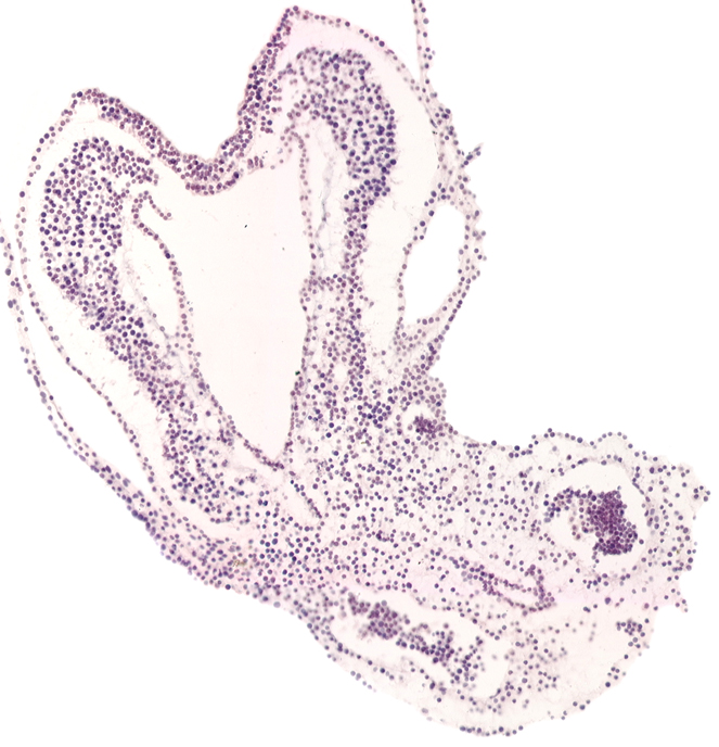 allantoic diverticulum, amnion attachment, artifact separation(s), left umbilical artery, left umbilical vein (terminal part), primordial left dorsal aorta, right umbilical artery, right umbilical vein (terminal part)