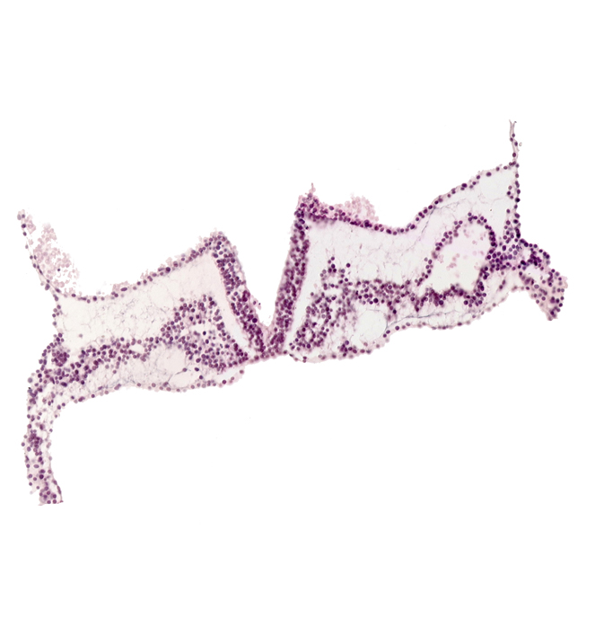 cephalic edge of somite 1 (O-1), primordial left dorsal aorta, primordial right dorsal aorta, rhombomere D (Rh. D), right vitelline (omphalomesenteric) artery, somitocoel 1