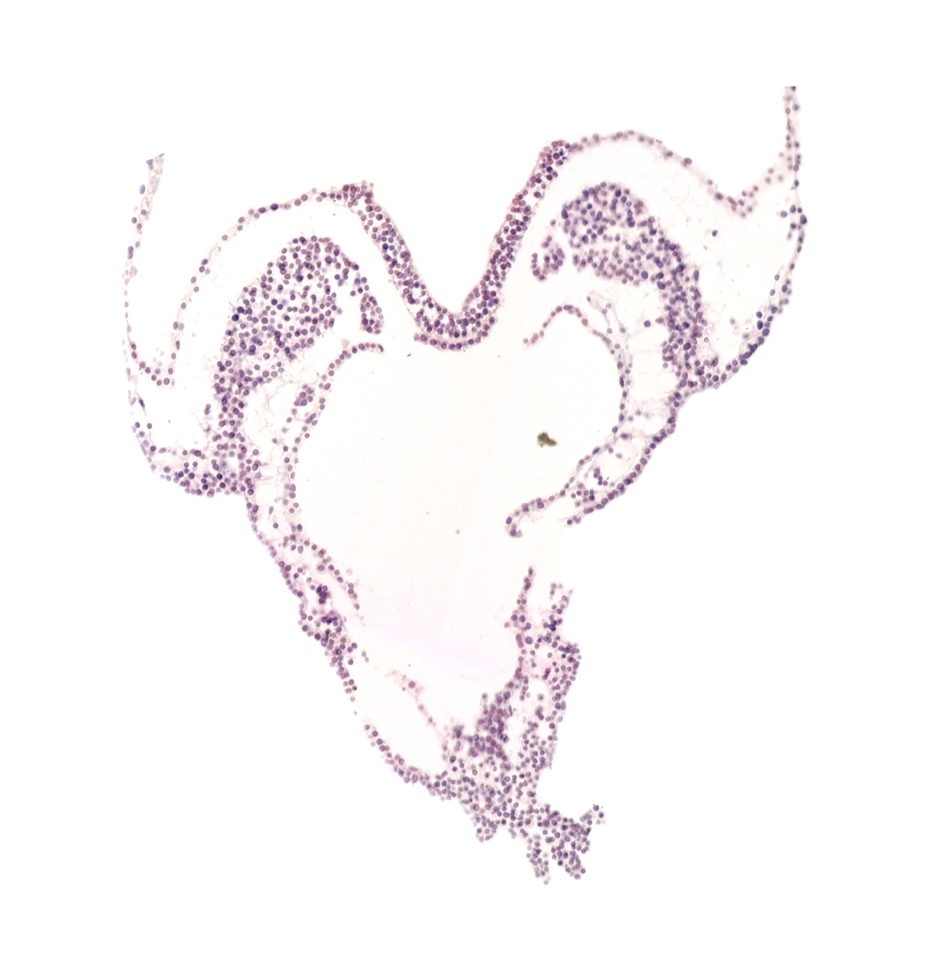 artifact separation(s)