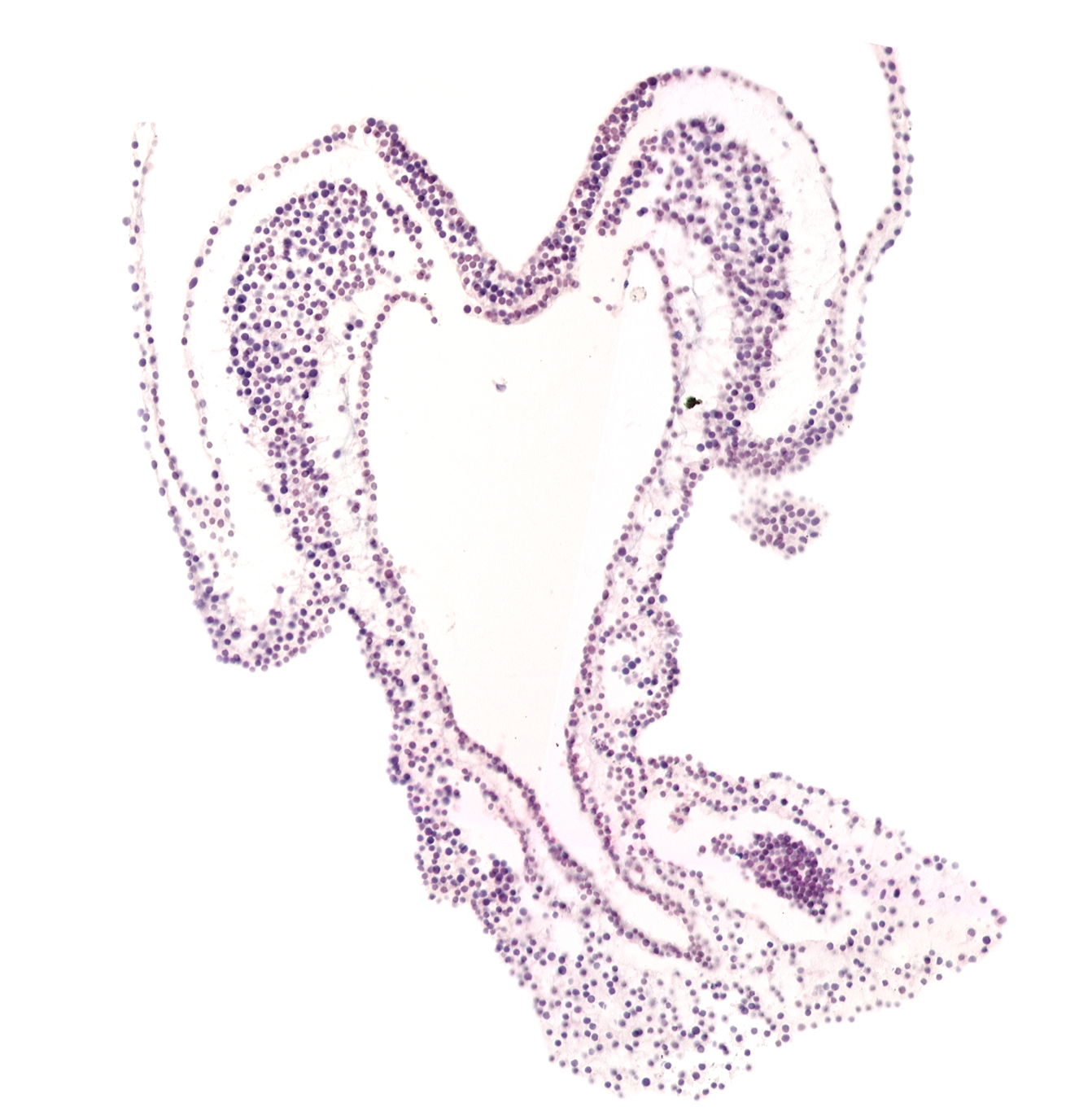 left umbilical artery, neural plate, notochordal plate, paraxial mesoderm, primordial left dorsal aorta, right umbilical artery