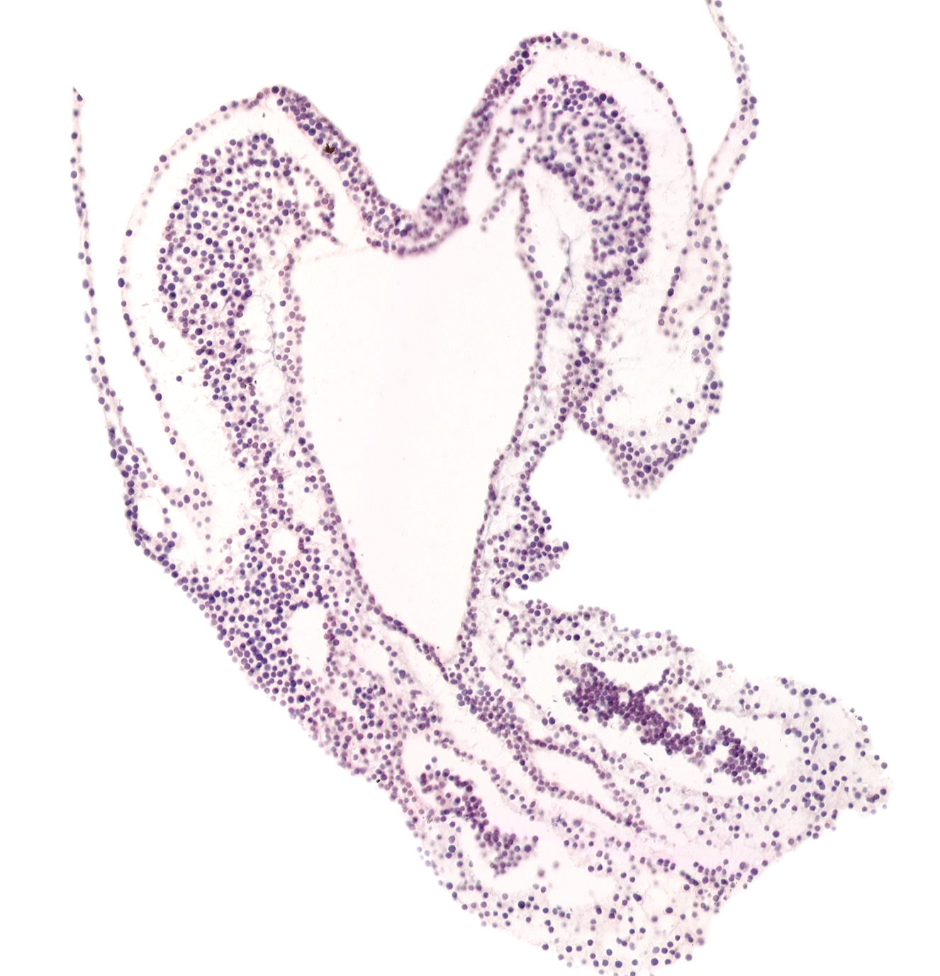 allantoic diverticulum, hindgut primordium (lumen), junction of allantoic diverticulum and hindgut, left umbilical artery, right umbilical artery