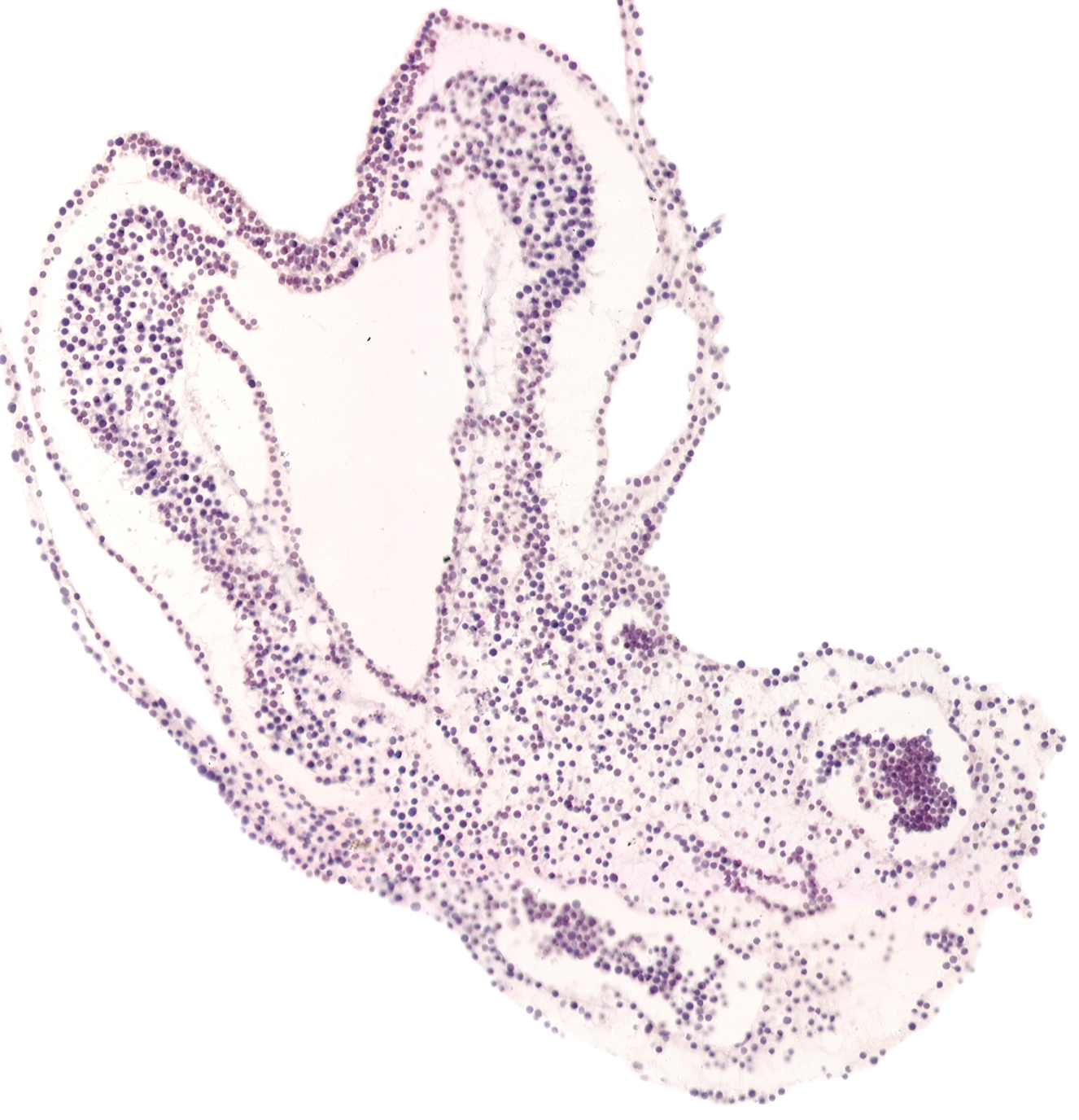 allantoic diverticulum, amnion attachment, artifact separation(s), left umbilical artery, left umbilical vein (terminal part), primordial left dorsal aorta, right umbilical artery, right umbilical vein (terminal part)