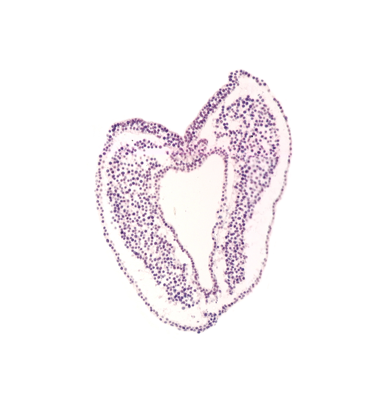 amnion attachment, cephalic part of gastrulation (primitive) groove, hindgut primordium (lumen), neural cord, spinal cord primordium, ventral ectodermal ridge