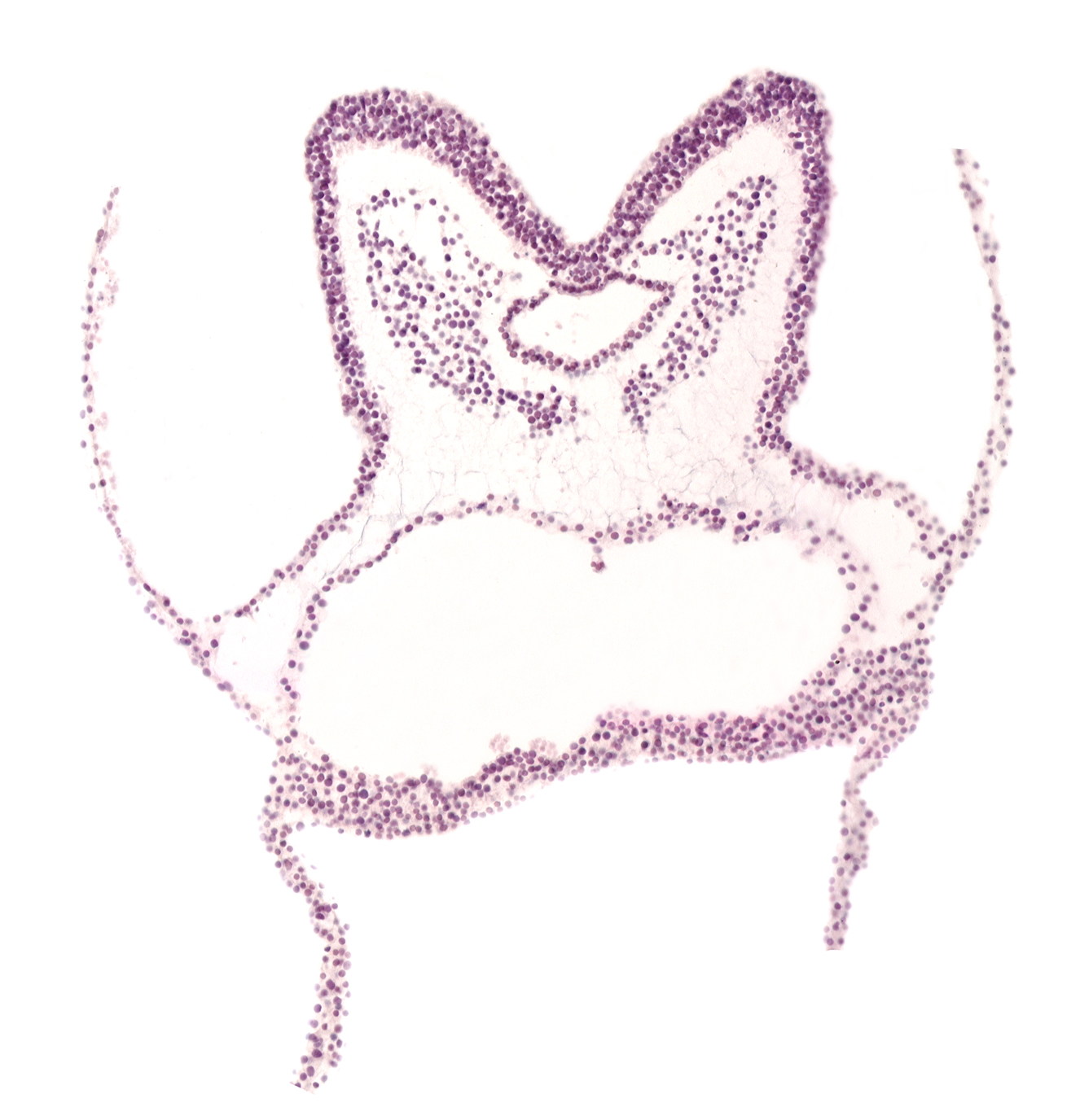 aortic arch 1, artifact separation(s), artifact space(s), foregut endoderm, foregut primordium (lumen), head mesenchyme, notochordal plate, pharyngeal pouch 1, primordial pericardial cavity, umbilical vesicle attachment