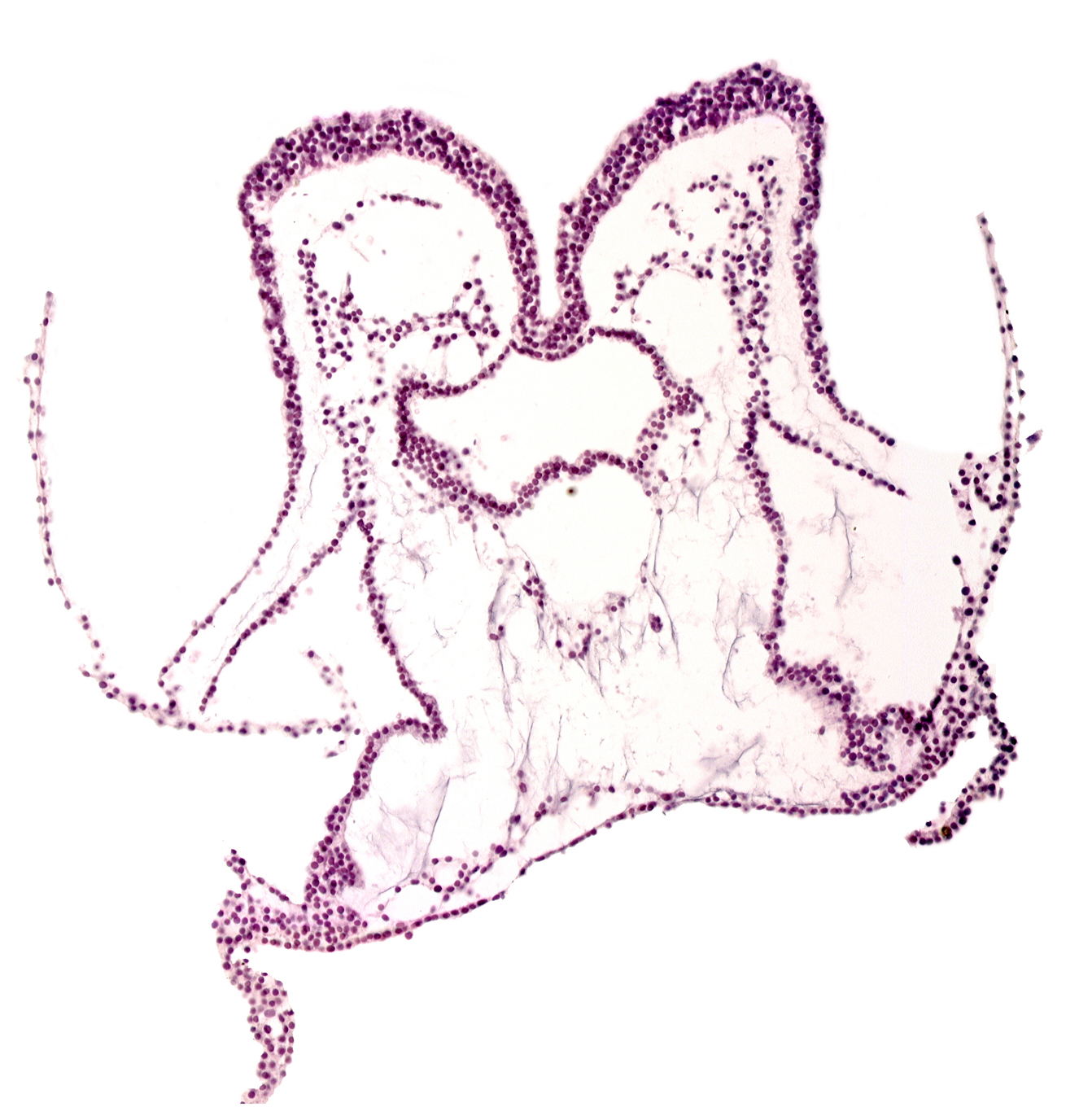 artifact separation(s), neural fold, neural groove, notochordal plate, presumptive left ventricle, presumptive right ventricle, primordial endocardium in midline, primordial epimyocardium, primordial left dorsal aorta