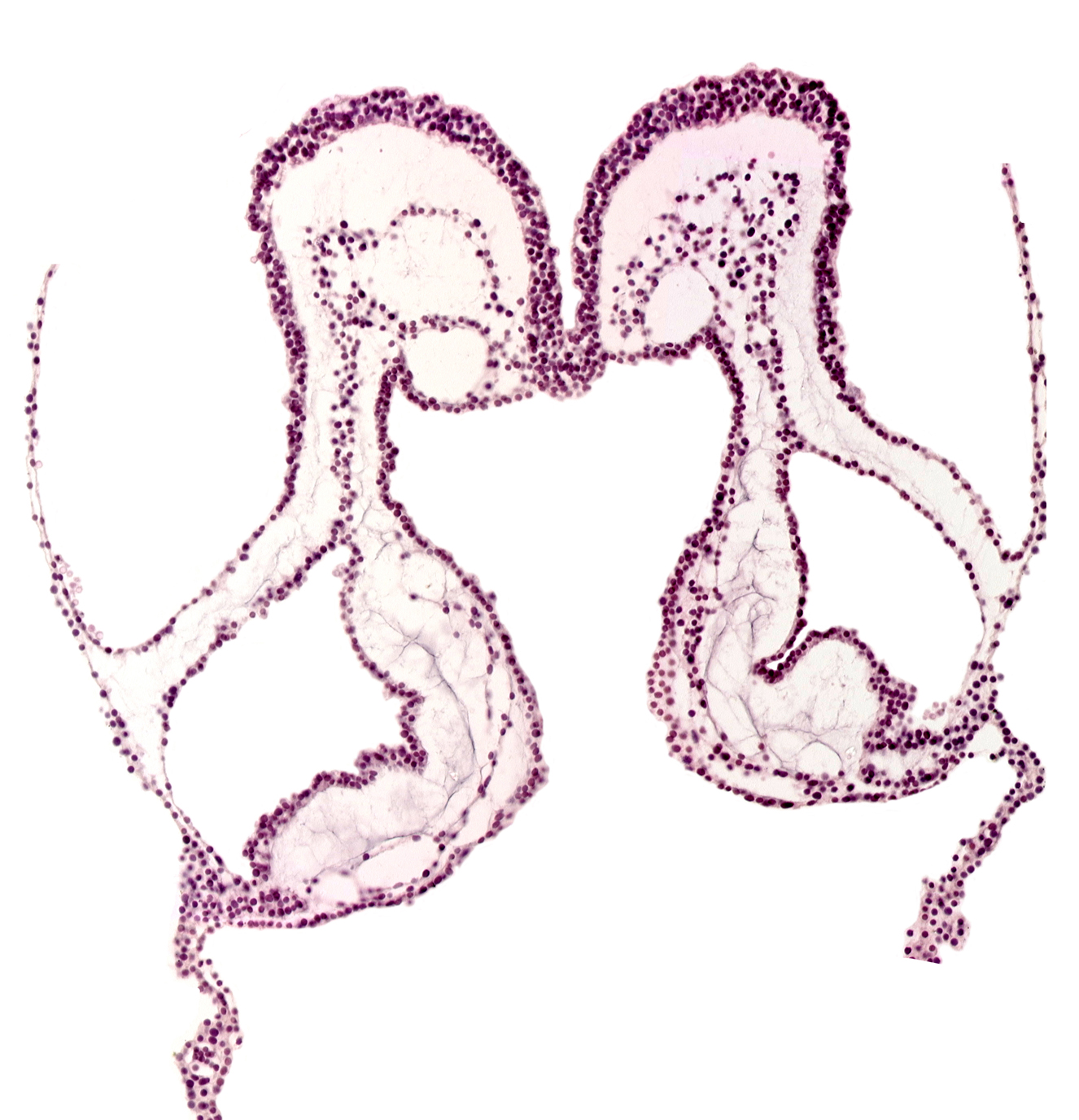 aortic arch 3, conotruncus, endoderm, head mesenchyme, interventricular sulcus, midgut primordium (lumen), neural fold, notochordal plate, presumptive left ventricle, presumptive right ventricle, primordial left dorsal aorta, primordial right dorsal aorta, umbilical vesicle cavity