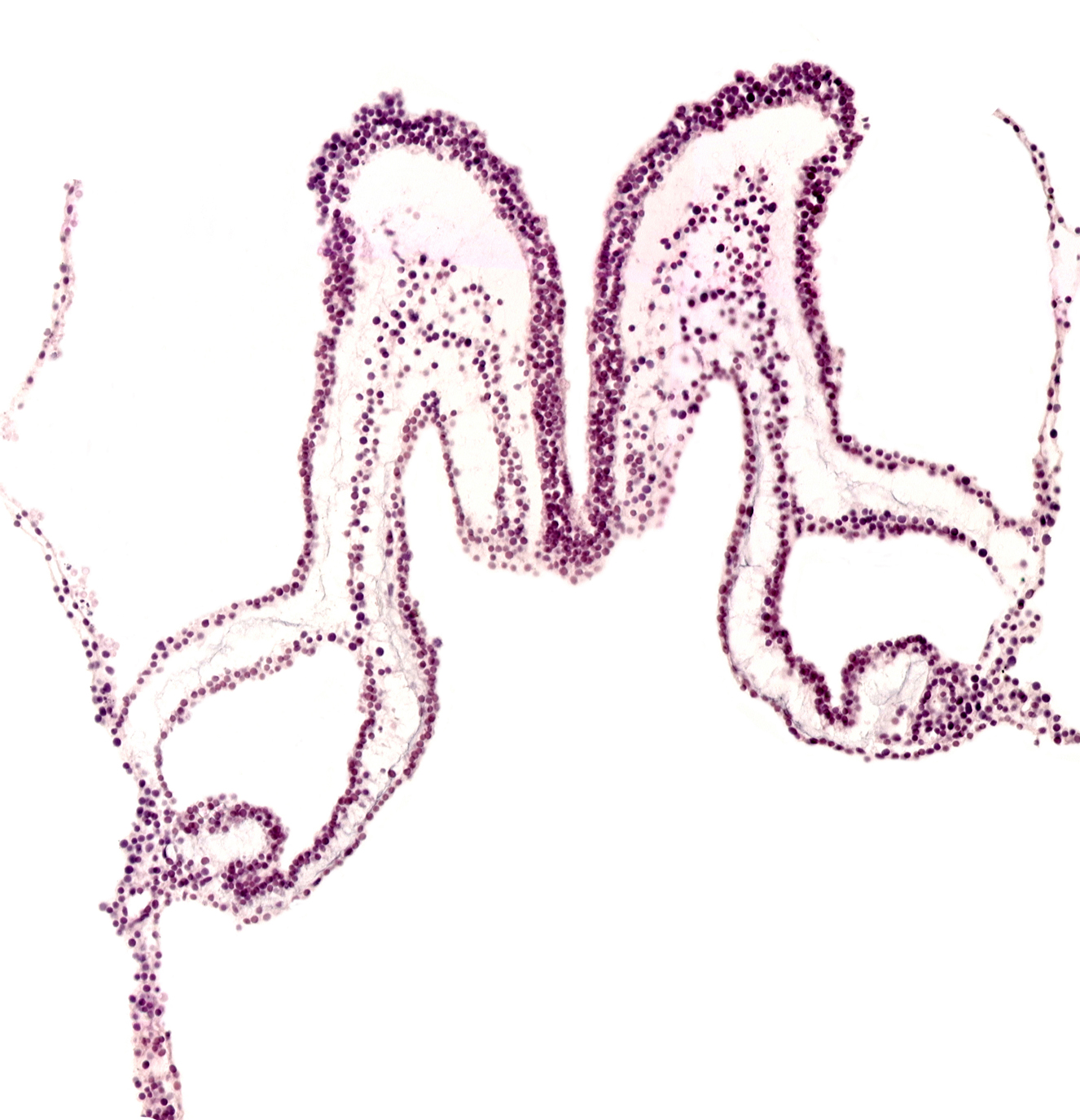 caudal part of primordial pericardial cavity, head mesenchyme, midgut primordium (lumen), rhombencephalon primordium (R), umbilical vesicle cavity