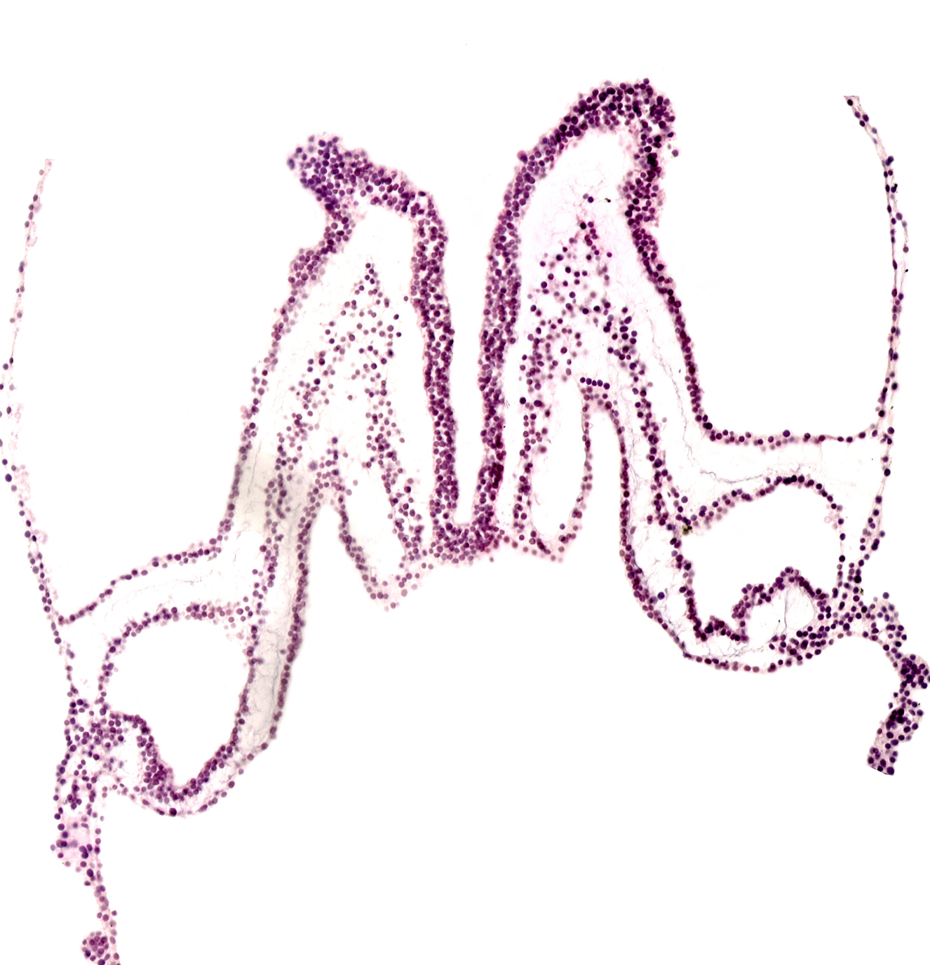 artifact separation(s), intra-embryonic coelom, midgut primordium (lumen), primordial left dorsal aorta, primordial neural crest (artifact separation), rhombencephalon primordium (R), umbilical vesicle cavity