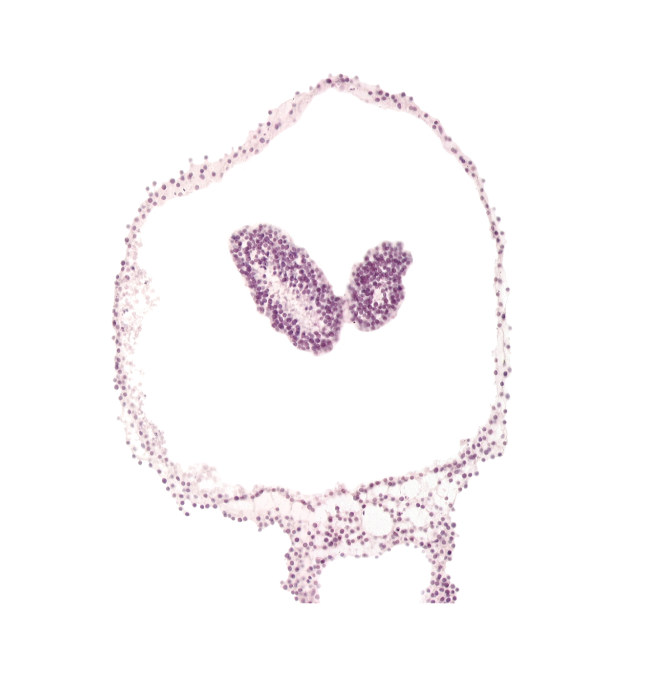amnion, amniotic cavity, artifact space(s), left neural fold, neural groove, prosencephalon primordium (P), right neural fold, umbilical vesicle cavity, umbilical vesicle wall