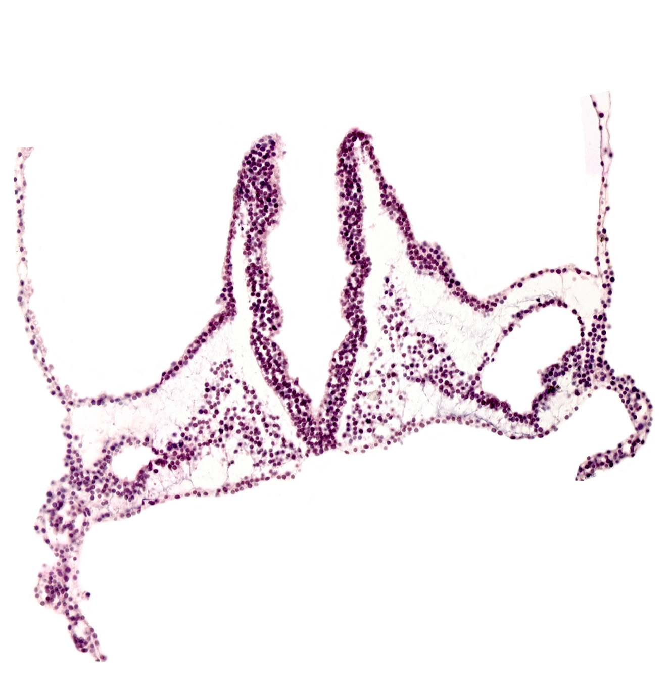extra-embryonic mesoderm, head mesenchyme, left vitelline (omphalomesenteric) artery, primordial left dorsal aorta, primordial otic placode, rhombomere A (Rh. A), rhombomere B (Rh. B), rhombomere C (Rh. C)
