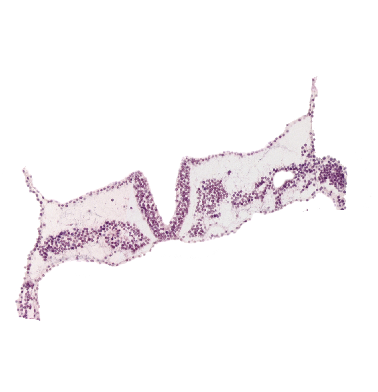 left vitelline (omphalomesenteric) vein, midgut primordium (lumen), primordial left dorsal aorta, rhombomere D (Rh. D), somite 1 (O-1), somite 2 (O-2), surface ectoderm