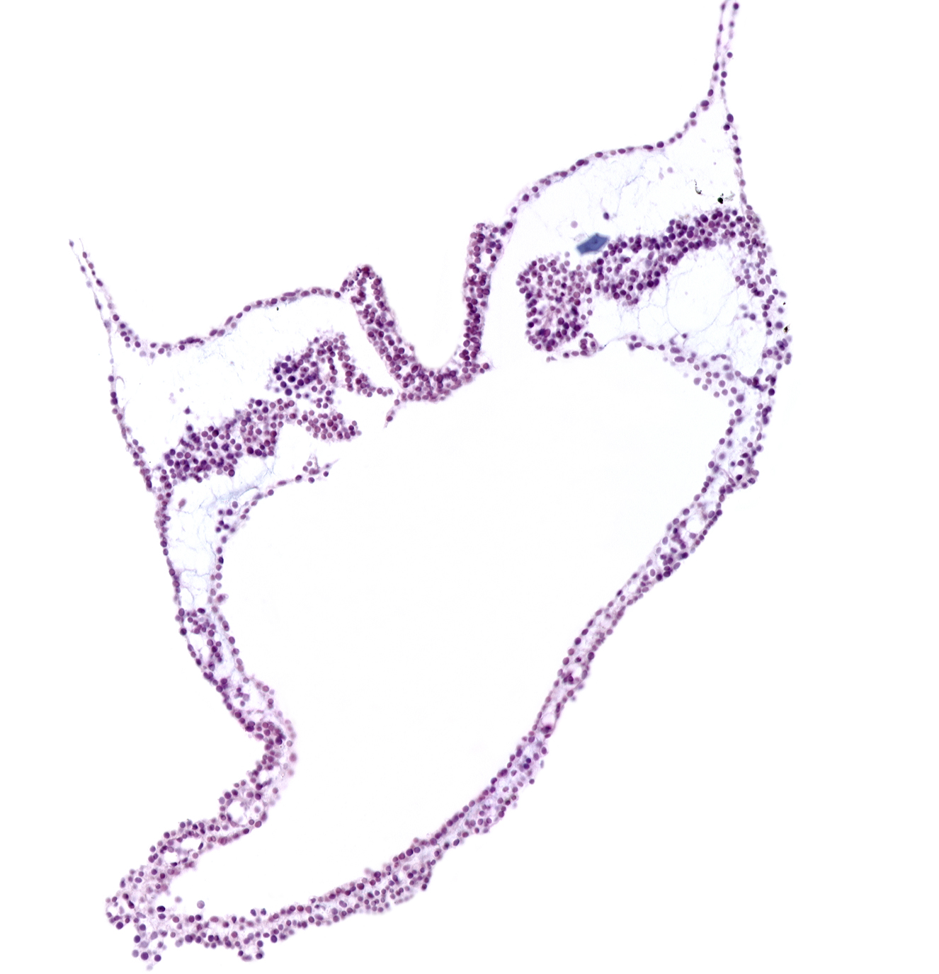 amnion attachment, artifact separation(s), intermediate mesenchyme, midgut primordium (lumen), paraxial mesoderm