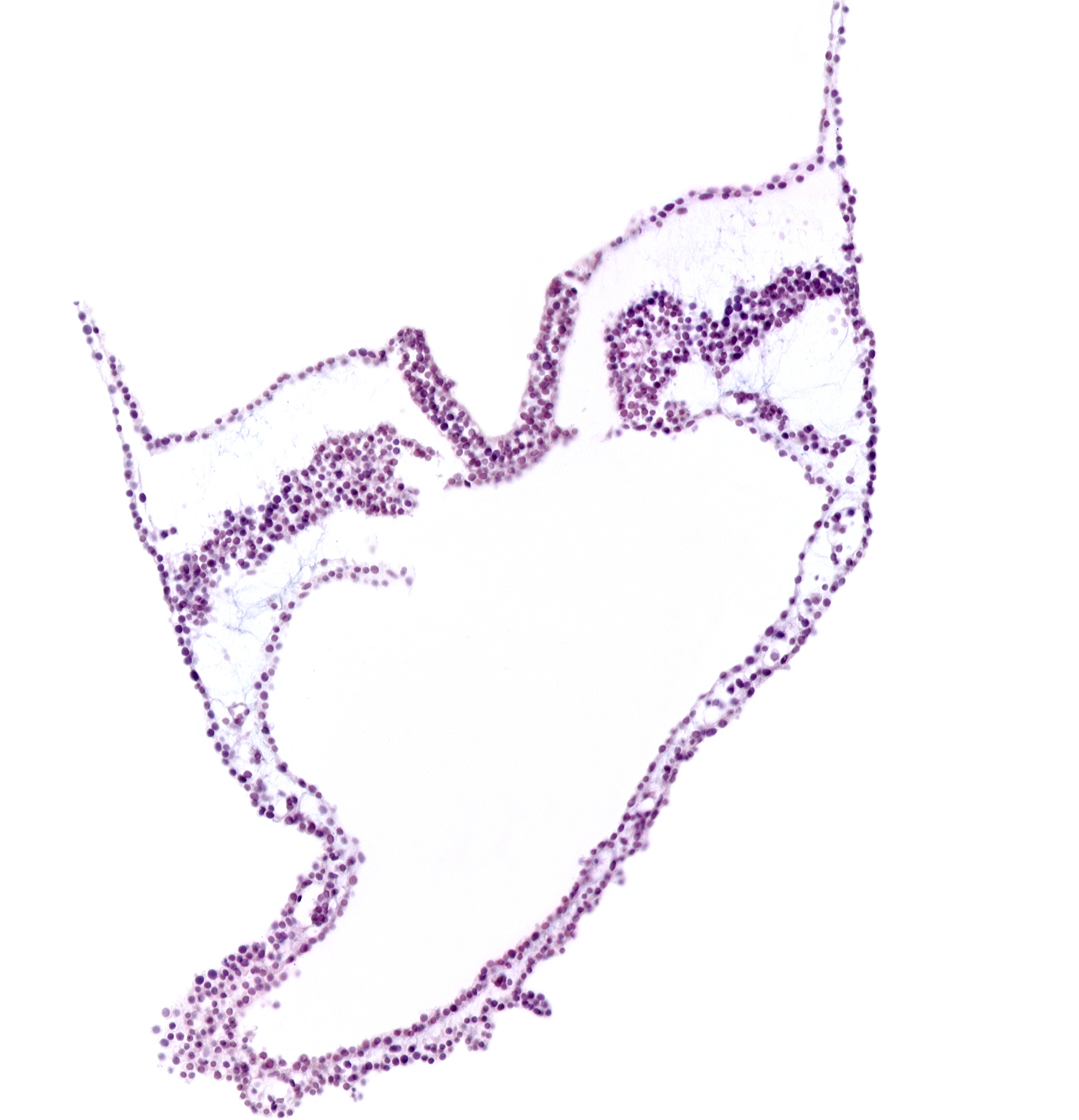 artifact separation(s), lateral plate mesoderm, left vitelline (omphalomesenteric) artery, notochordal plate, primordial left dorsal aorta, spinal cord part of neural plate, umbilical vesicle attachment