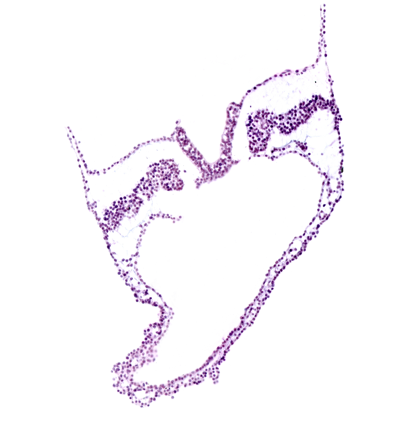 amnion attachment, endoderm, lateral plate mesoderm, midgut primordium (lumen), neural plate, paraxial mesoderm, surface ectoderm