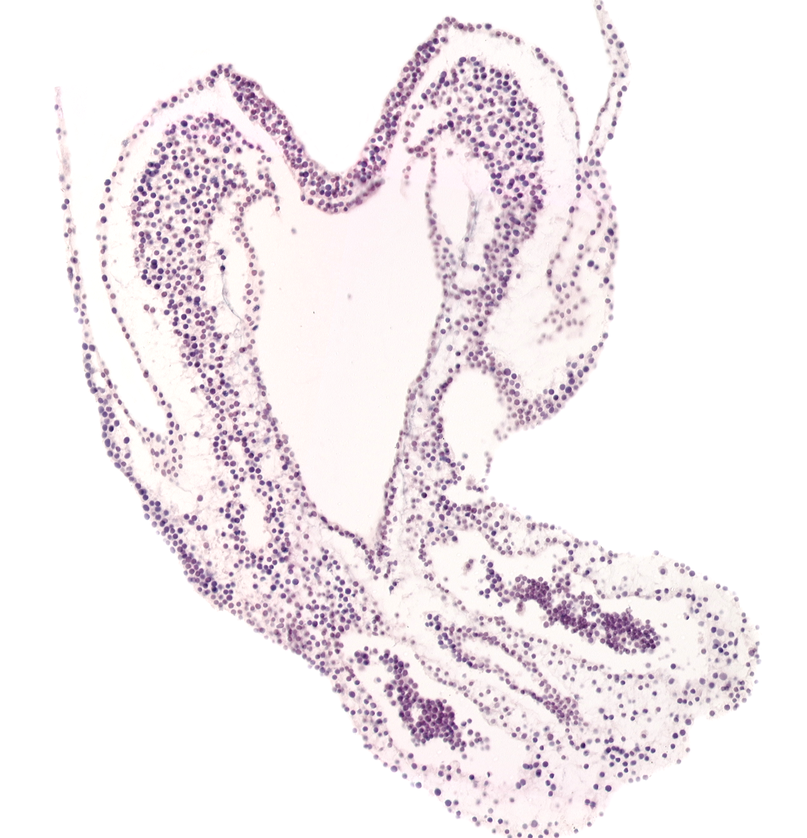 allantoic diverticulum, amnion attachment, connecting stalk, hindgut primordium (lumen), left umbilical artery, notochordal plate, primordial left dorsal aorta, right umbilical artery