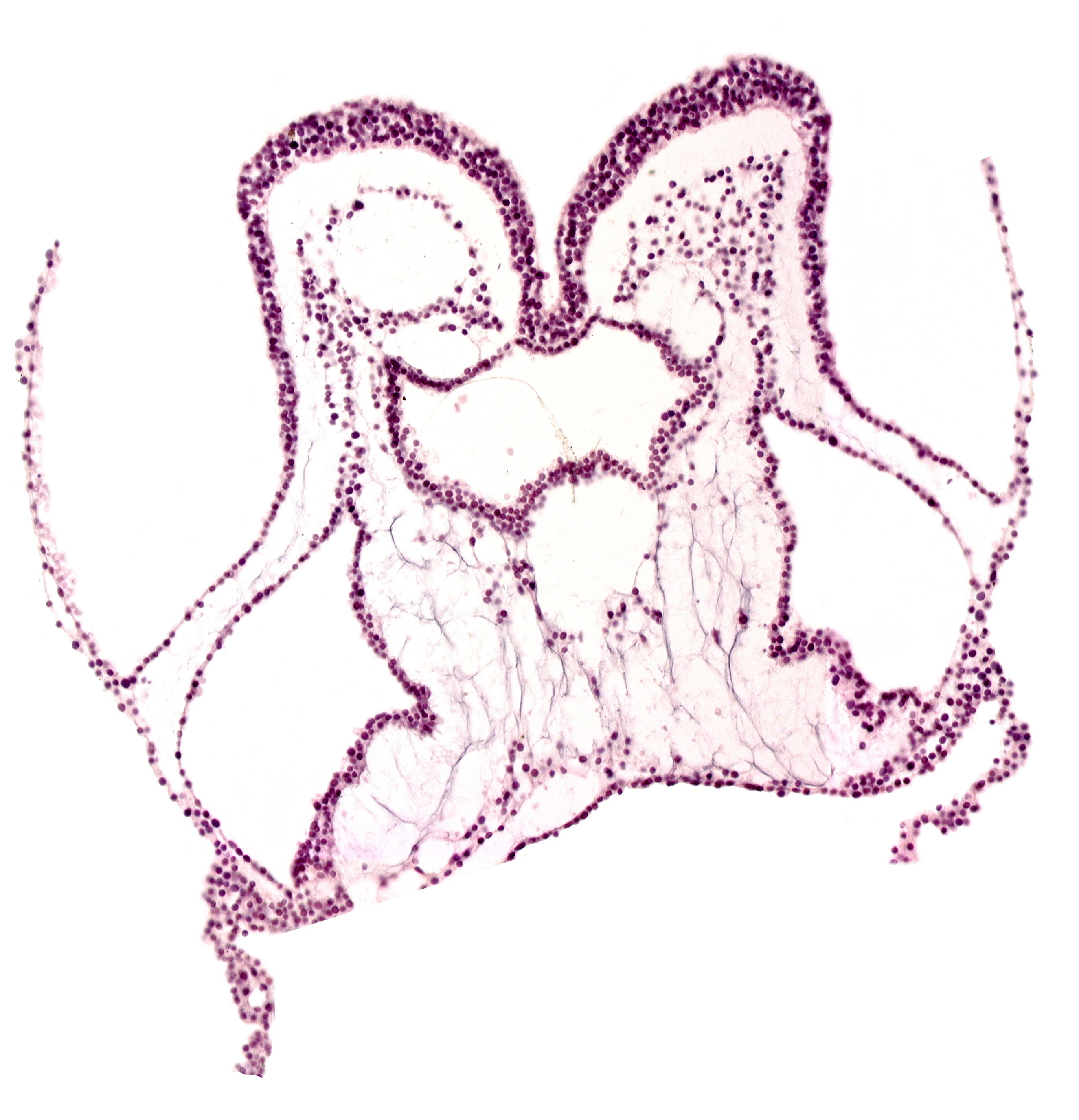 amnion attachment, amniotic cavity, artifact separation(s), foregut primordium (lumen), interventricular sulcus, mesencephalon primordium (M), pharyngeal pouch 2, presumptive left ventricle, presumptive right ventricle, primordial left dorsal aorta, primordial neural crest (artifact separation), umbilical vesicle cavity, umbilical vesicle wall