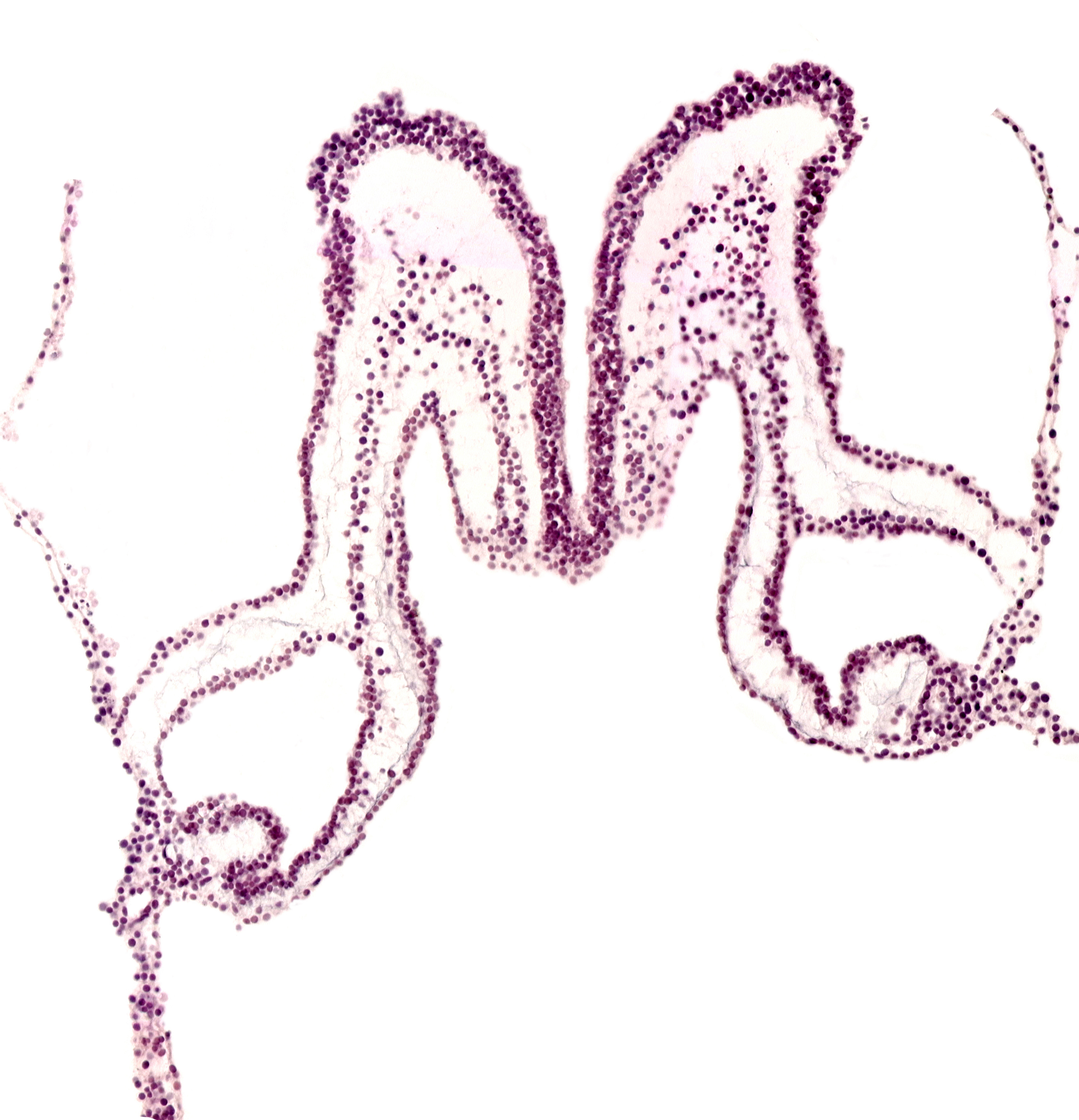 caudal part of primordial pericardial cavity, head mesenchyme, midgut primordium (lumen), rhombencephalon primordium (R), umbilical vesicle cavity