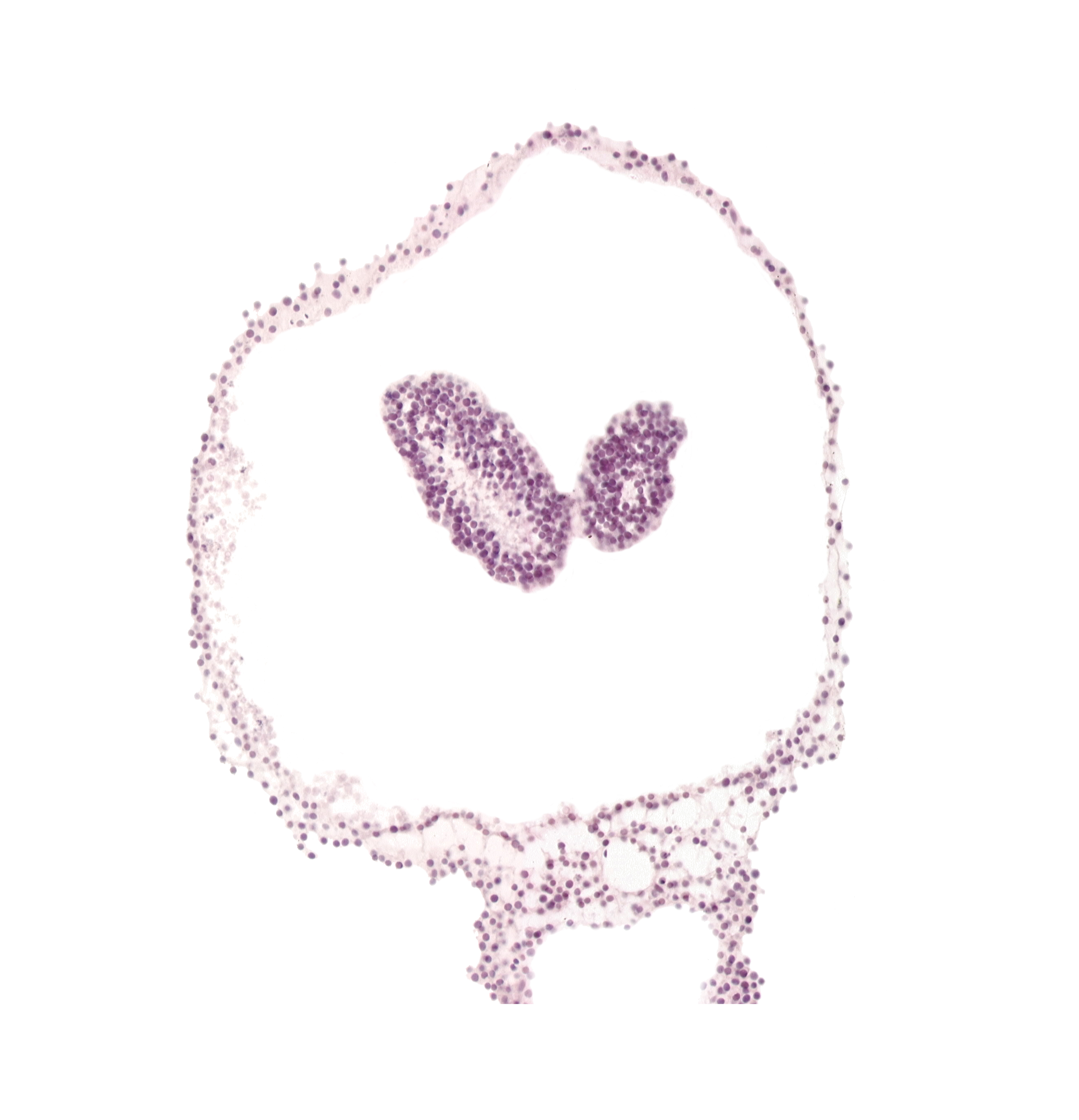 amnion, amniotic cavity, artifact space(s), left neural fold, neural groove, prosencephalon primordium (P), right neural fold, umbilical vesicle cavity, umbilical vesicle wall