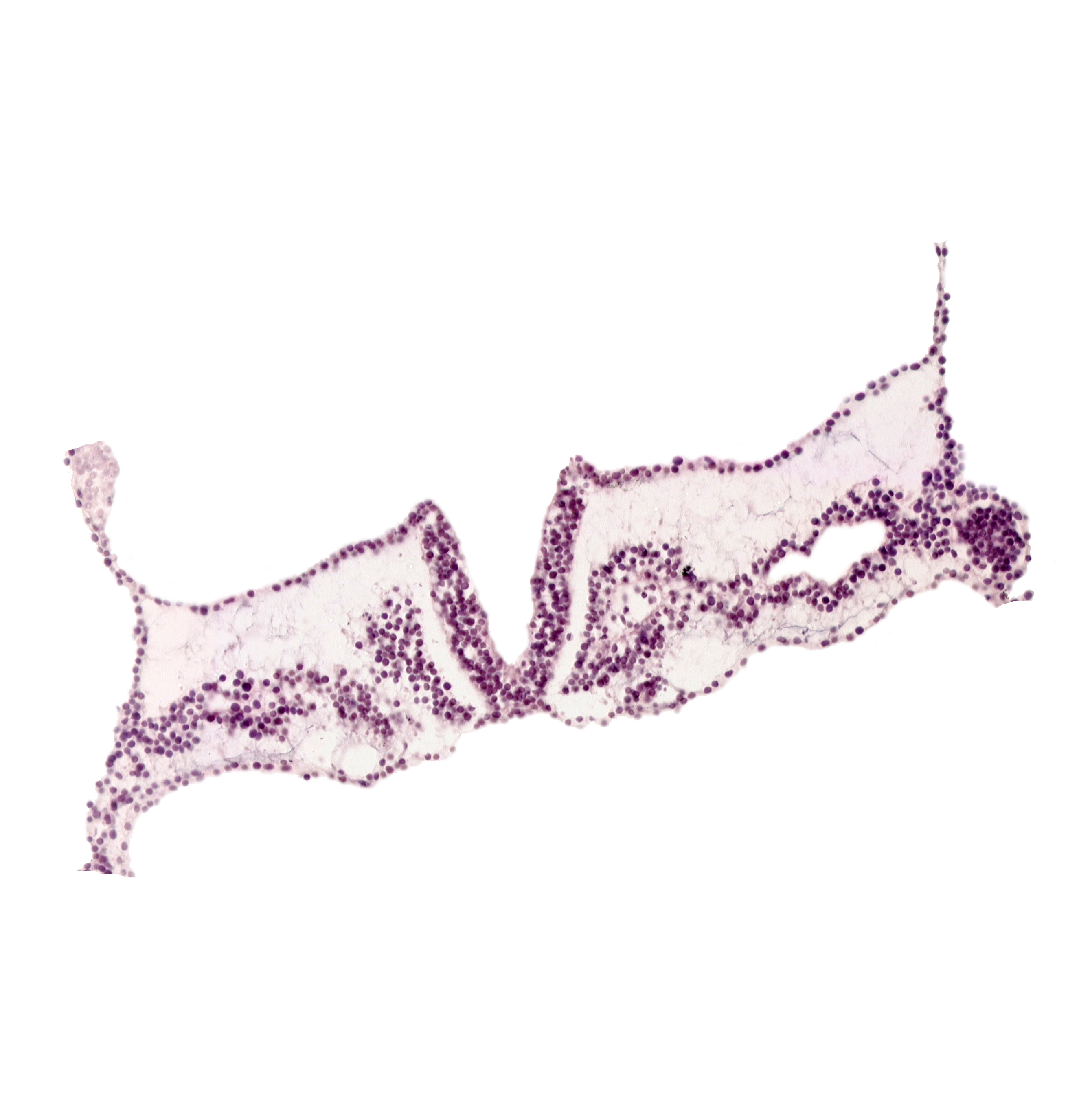 intermediate mesenchyme, left vitelline (omphalomesenteric) vein, rhombencephalon primordium (R), somite 1 (O-1), somitocoel 1, surface ectoderm, umbilical vesicle attachment