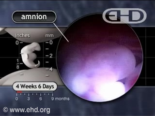 Play Movie - Amniotic Fluid