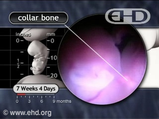 Play Movie - Bone Formation