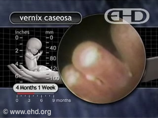 Play Movie - 4 months 2 weeks fetus, Vernix Caseosa