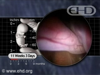 Play Movie - 11 weeks 3 days fetus, The Intestines Return