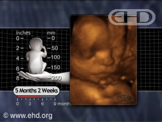 Play Movie - 5 months 2 weeks fetus, Age of Viability