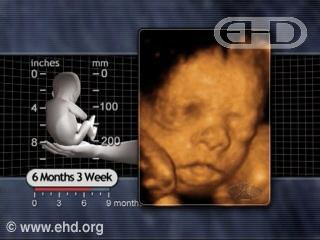 Play Movie - 6 months 3 week fetus, More Fat, Less Wrinkles