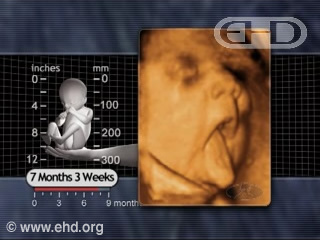 Play Movie - 7 month fetus, Breathing Movements