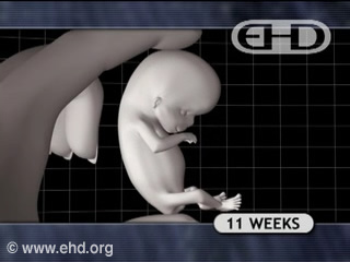 Play Movie - Human fetus 11 to 12 weeks