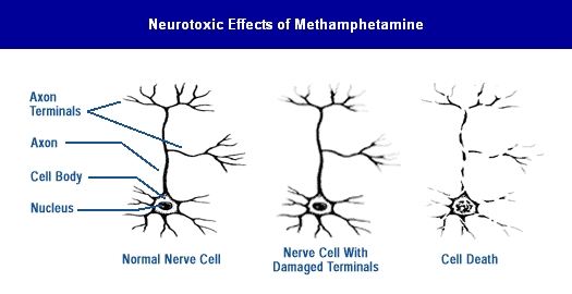 neurotoxic effects of methamphetamine