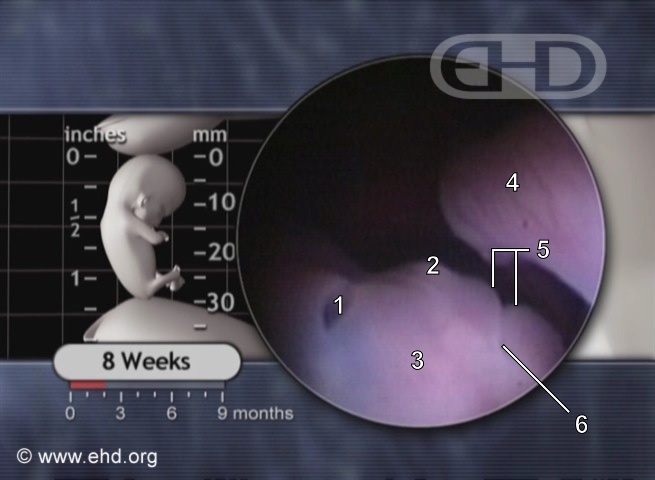 The Eye at 8 Weeks Pregnant