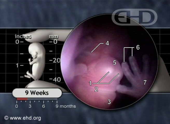 The Face at 9 Weeks