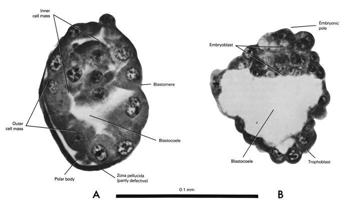 Open PDF version of FIG 1-3, The 58-cell blastocyst and the 107-cell (unilaminar) blastocyst