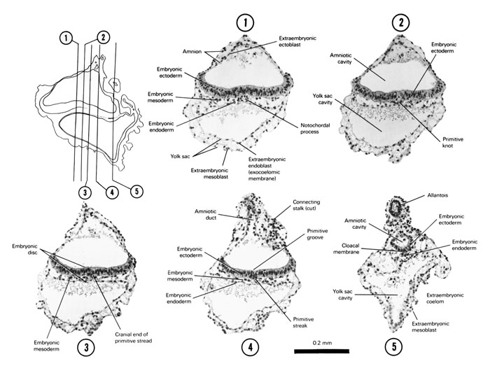 Open PDF version of FIG 3-2, A section through the cranial part of the embryonic disc, the primitive knot, the cranial part of the primitive streak, the middle of the primitive streak, the caudal end of the embryonic disc.