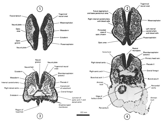 Open PDF version of FIG 4-4, A section through the open curved part of the prosencephalon showing its junction with the mesencephalon. A section through the ventral part of the prosencephalon at its junction with the mesencephalon. A section through the cranial end of the foregut showing its separation from the exterior by the two-layered, oropharyngeal membrane. A section through the first branchial arch and the cranial part of the pericardial cavity.