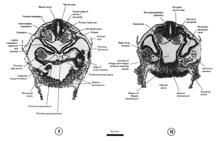 Open PDF version of FIG 4-7, A section through the caudal part of somite 1 and the pericardial cavity at the level of the lung primordium. A section through somite 2, the sinus venosus and the fore- and midgut junction.