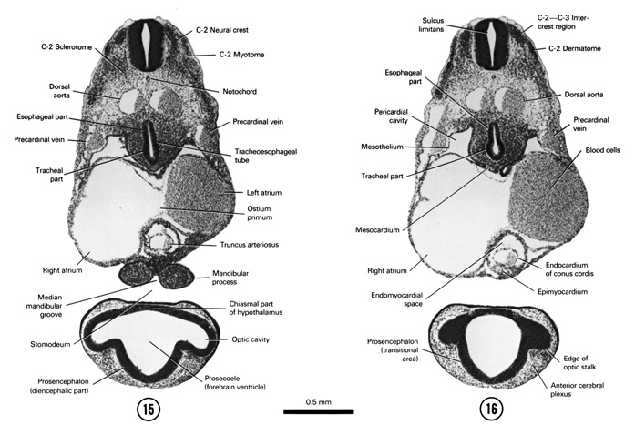 Open PDF version of FIG 5-13, A section through the C-2 neural crest and the cranial edge of the ostium primum. A section through the C-2–C-3 intercrest region and the junction of the telencephalic and diencephalic parts of the prosencephalon.