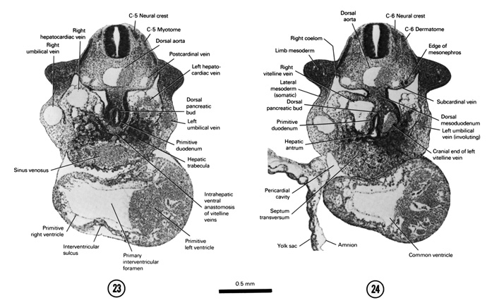 Open PDF version of FIG 5-17, A section through the C-5 neural crest and the primary interventricular foramen. A section through the C-6 neural crest, cranial end of the mesonephros and hepatic antrum.