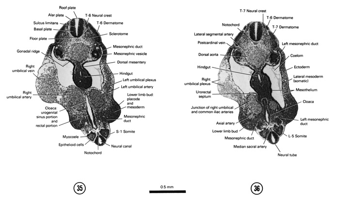 Open PDF version of FIG 5-23, A section through the T-6 neural crest, S-1 somite and the cloaca. A section through the T-7 neural crest, L-5 somite and the urorectal septum.