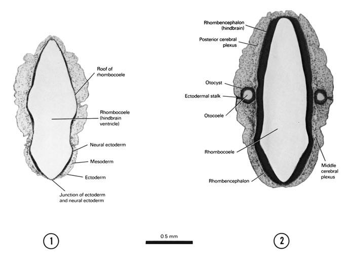 Open PDF version of FIG 5-6, A section through the roof of the rhombencephalon. A section through the thicker, dorsal part of the rhombencephalon and the dorsal part of the otocyst.