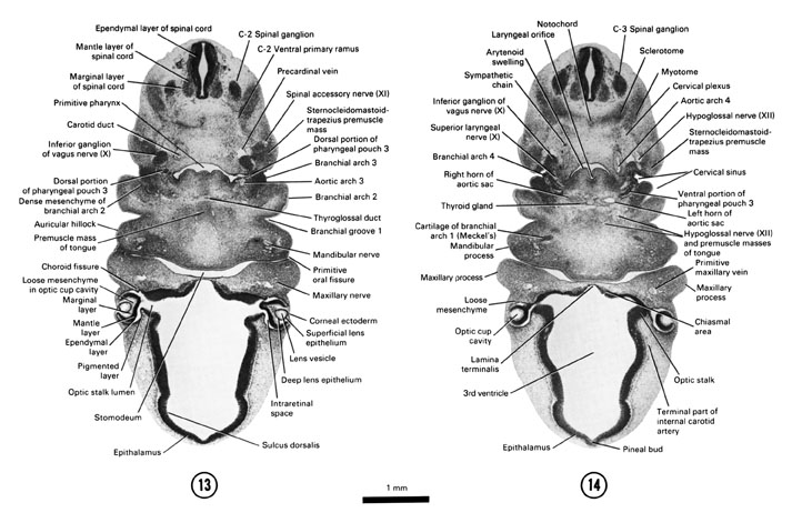 Open PDF version of FIG 6-12, A section through the optic stalk lumen and lens vesicle. A section through the C-3 spinal ganglion, branchial arches and thyroid gland.