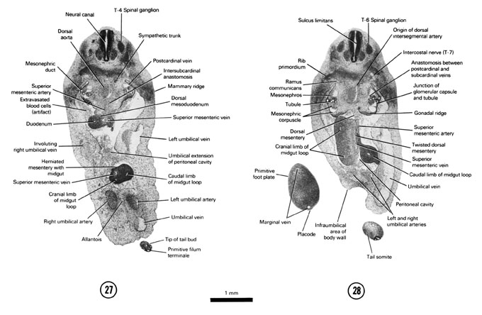 Open PDF version of FIG 6-19, A section through the T-4 spinal ganglion, herniated midgut and tip of the tail bud. A section through the T-6 spinal ganglion and junction of the umbilical vessels with the ventral body wall.