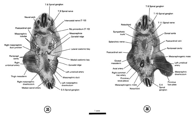 Open PDF version of FIG 6-23, A section through the T-8 and S-5 spinal ganglia. A section through the T-9 and S-4 spinal ganglia.