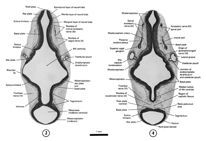 Open PDF version of FIG 6-7, A section through the middle of the fourth ventricle and rootlets of the vagus and cranial accessory nerves. A section through the region of the cephalic flexure, rootlets of the oculomotor nerve and origin of the glossopharyngeal nerve.